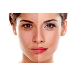 ΔΥΣΧΡΩΜΙΕΣ