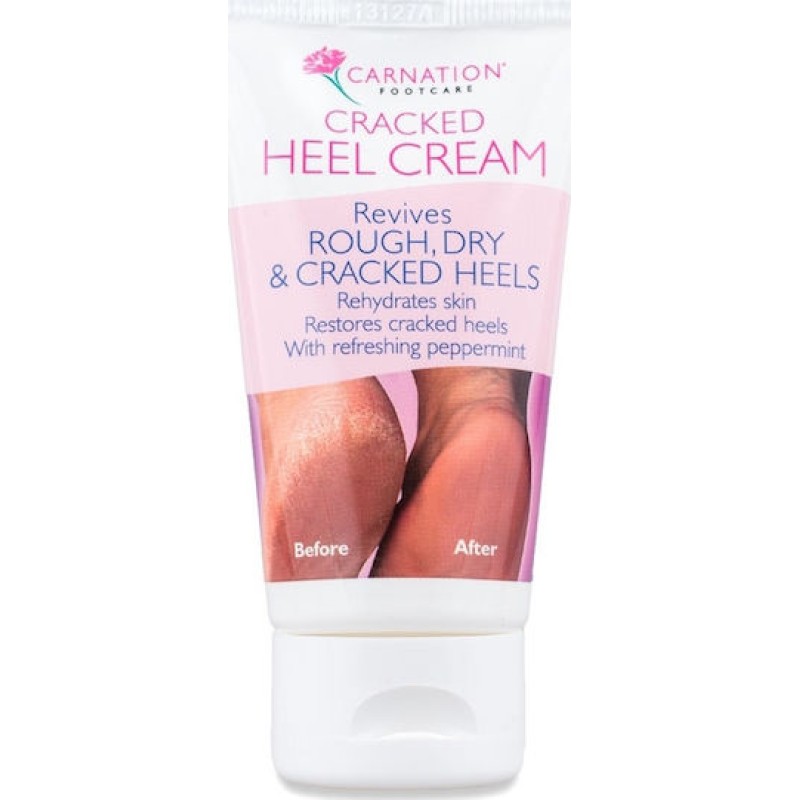 Carnation Carnation Cracked Heel Ενυδατική Κρέμα για Σκασμένες Φτέρνες με Ουρία 50ml