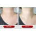 MediPeel Premium 2.0 Collagen Naite Thread Neck Cream - Αντιγηραντική κρέμα λαιμού με κολλαγόνο 100ml