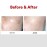 Medipeel Melanon X Cream 73% - Ενυδατική κρέμα για σκούρες κηλίδες και δυσχρωμίες, 30ml
